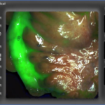 Surgical Fluorescence Imaging System