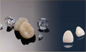 All You Need to Know About Designing Zirconia Crowns