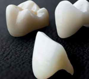 What is a dental bridge and how does it work to replace missing teeth?